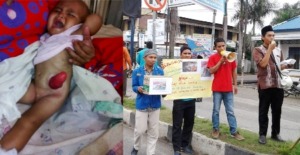 4,7 Juta Rupiah Terkumpul Untuk Kurniawan Bocah Tanpa Anus