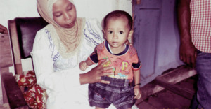 Balita Penderita Jantung Bocor Butuh Bantuan Dermawan