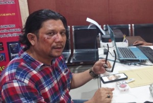 Oknum Suruhan Ketua OKP Aniaya Wartawan di Madina