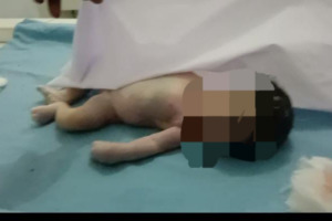 Tokoh Agama Aek Galoga Minta Polisi Segera Ungkap Pelaku Pengubur Jasad Bayi 