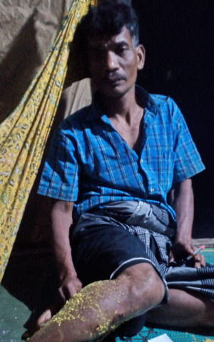 Pasca Serangan Beruang, Warga Desa Roburan Dolok Takut Kekebun