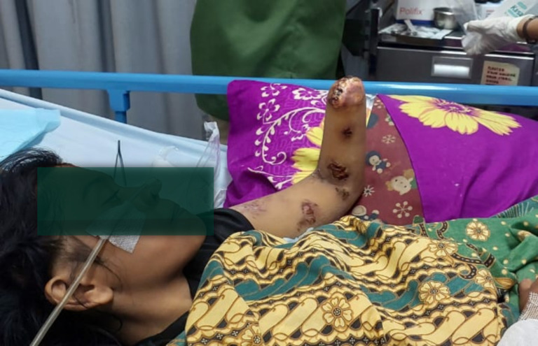 Dugaan Malapraktik, Kuasa Hukum Minta Penjelasan RS Permata Madina