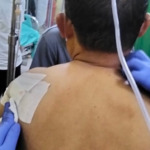 BREAKING NEWS: Anggota DPRD Madina Fraksi Demokrat Ditusuk di TPU Saat Antar Jenazah